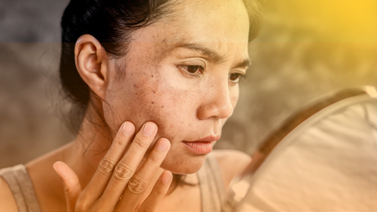 Como o Ayurveda Cura o Melasma: O Caminho Holístico para Tratar a Pigmentação da Pele de Dentro para Fora